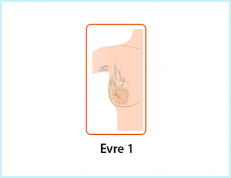 meme-kanseri-evre-1